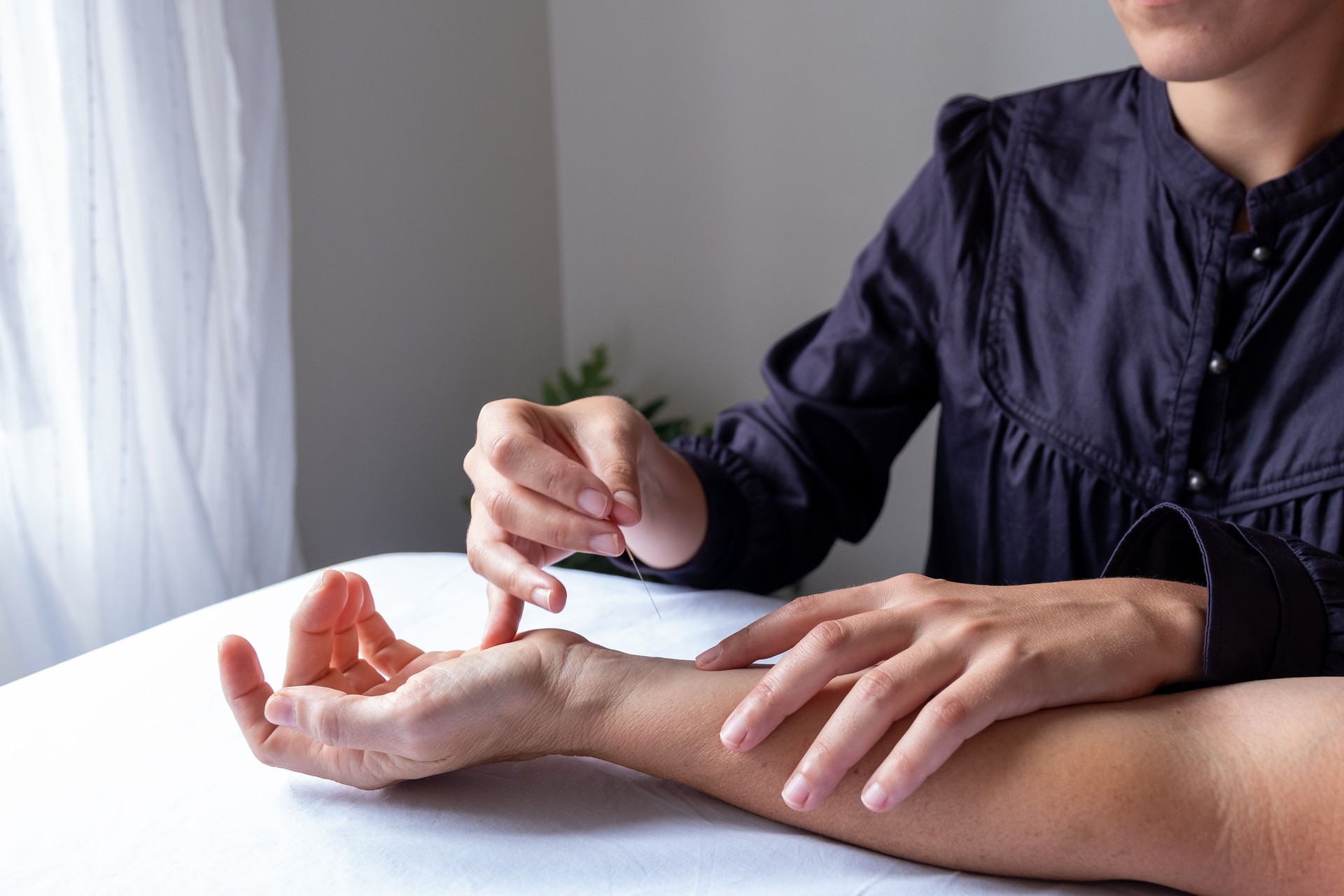 Acupuncturist performing a treatment on a patient's arm in a calm setting, in Montreal, Canada